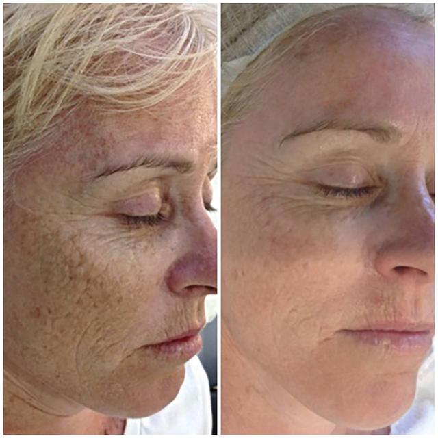 Benefit image