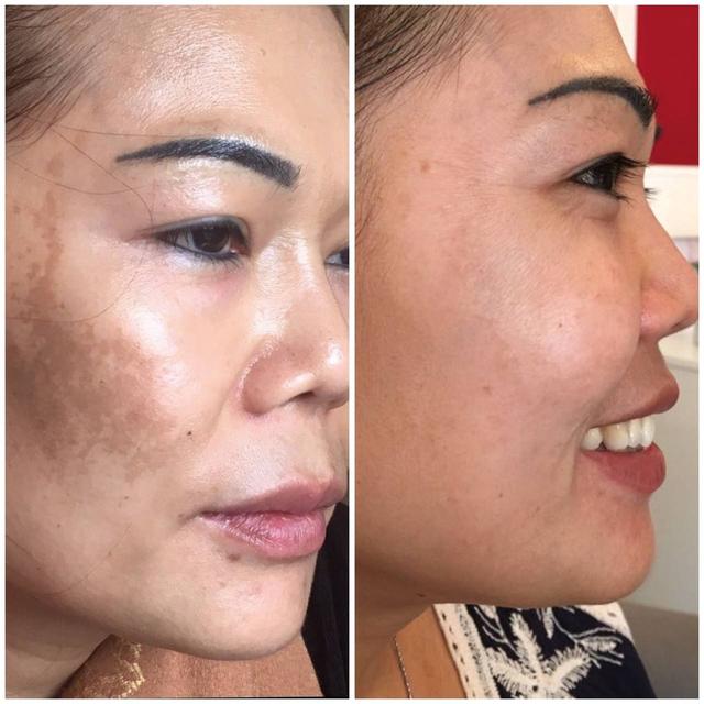 Benefit image
