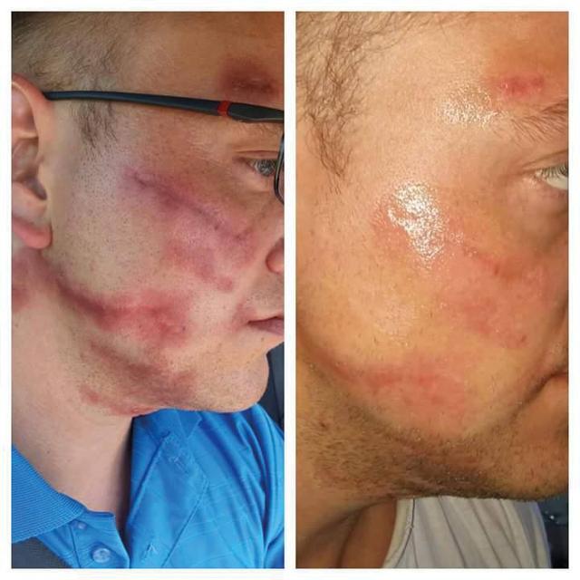 Benefit image