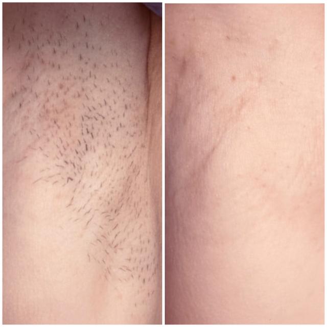 Benefit image