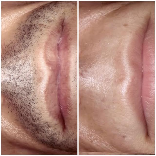 Benefit image