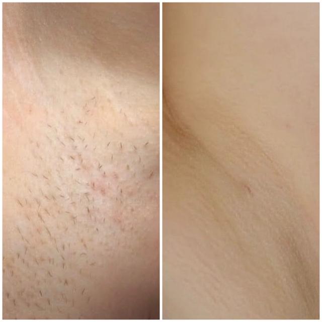 Benefit image
