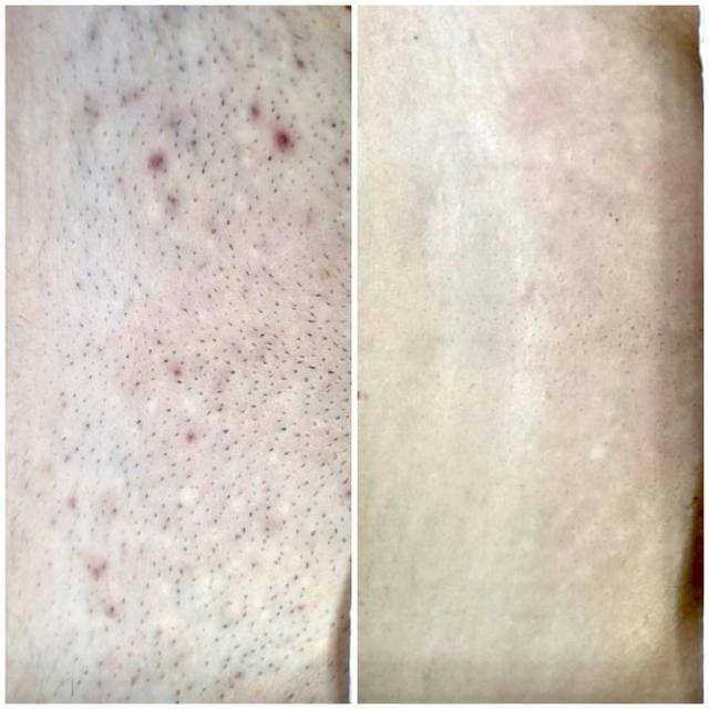 Benefit image