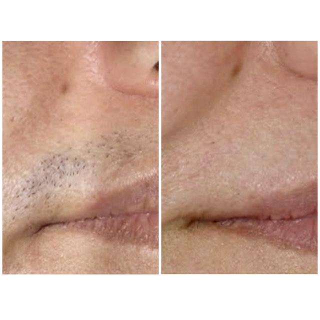 Benefit image
