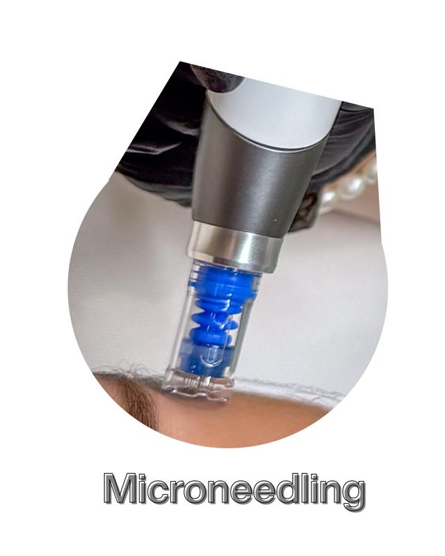 Microneedling with Dermapen 4™