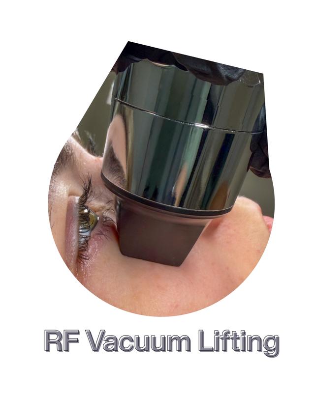 RF Vacuum eyes (Radiofrequency Vacuum)