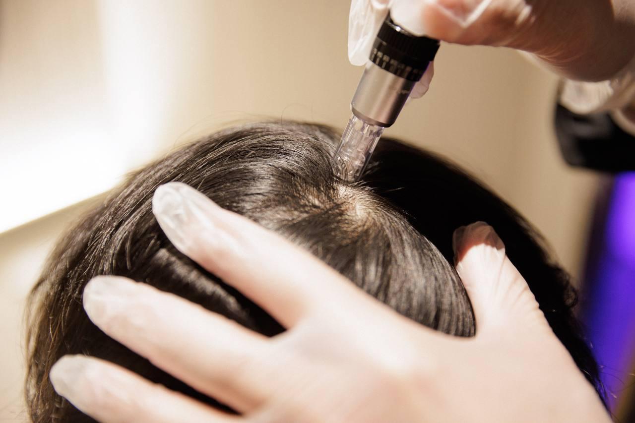 Scalp Health