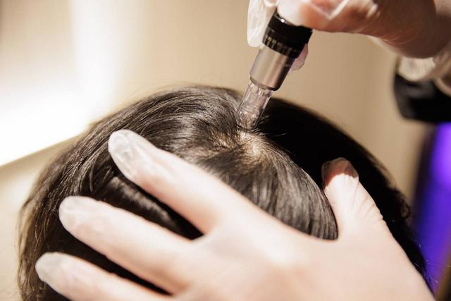 Scalp Health