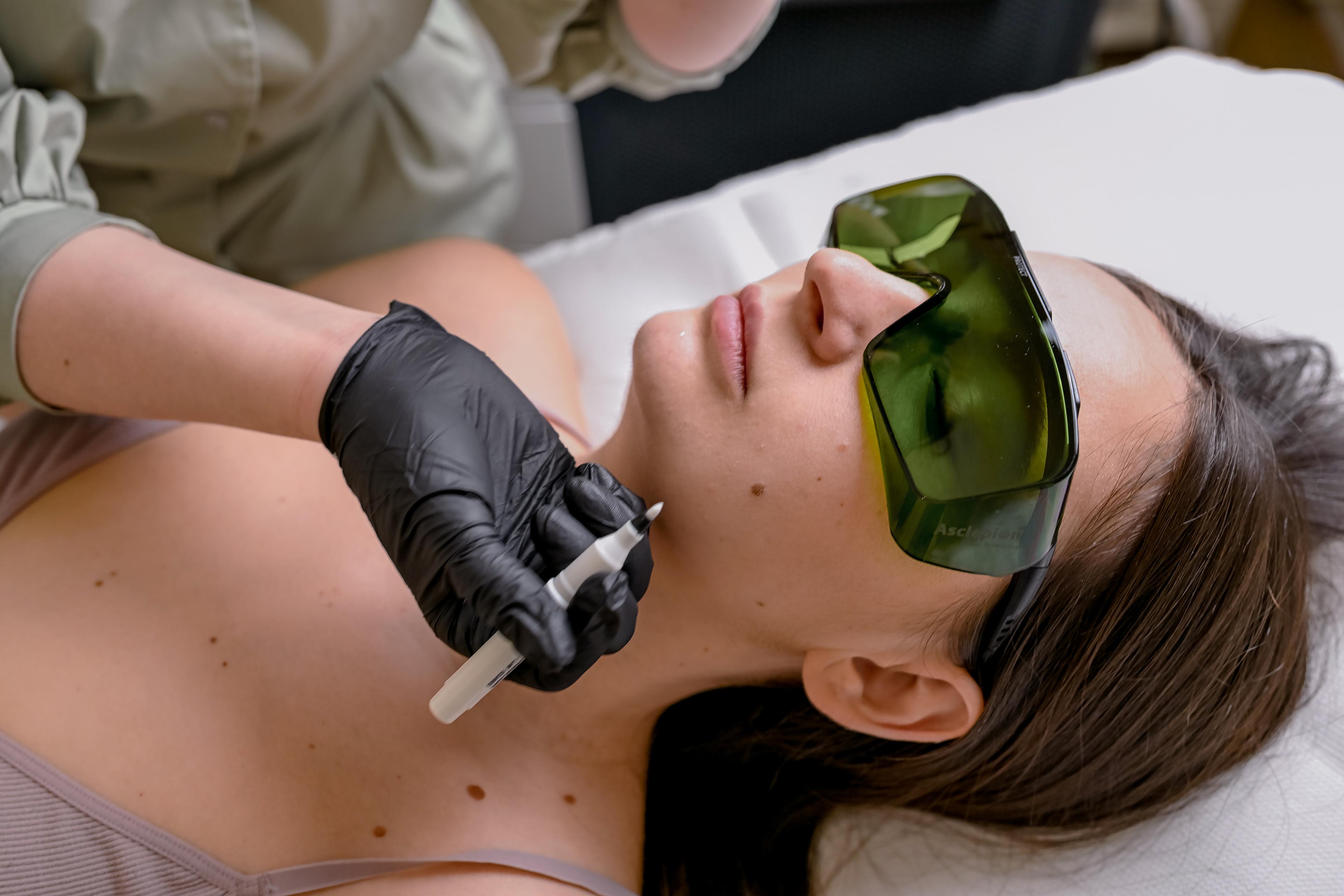 Free Skin Consultation