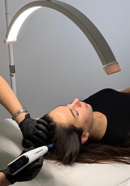 Microneedling Hair with Dermapen 4™ (for Scalp)