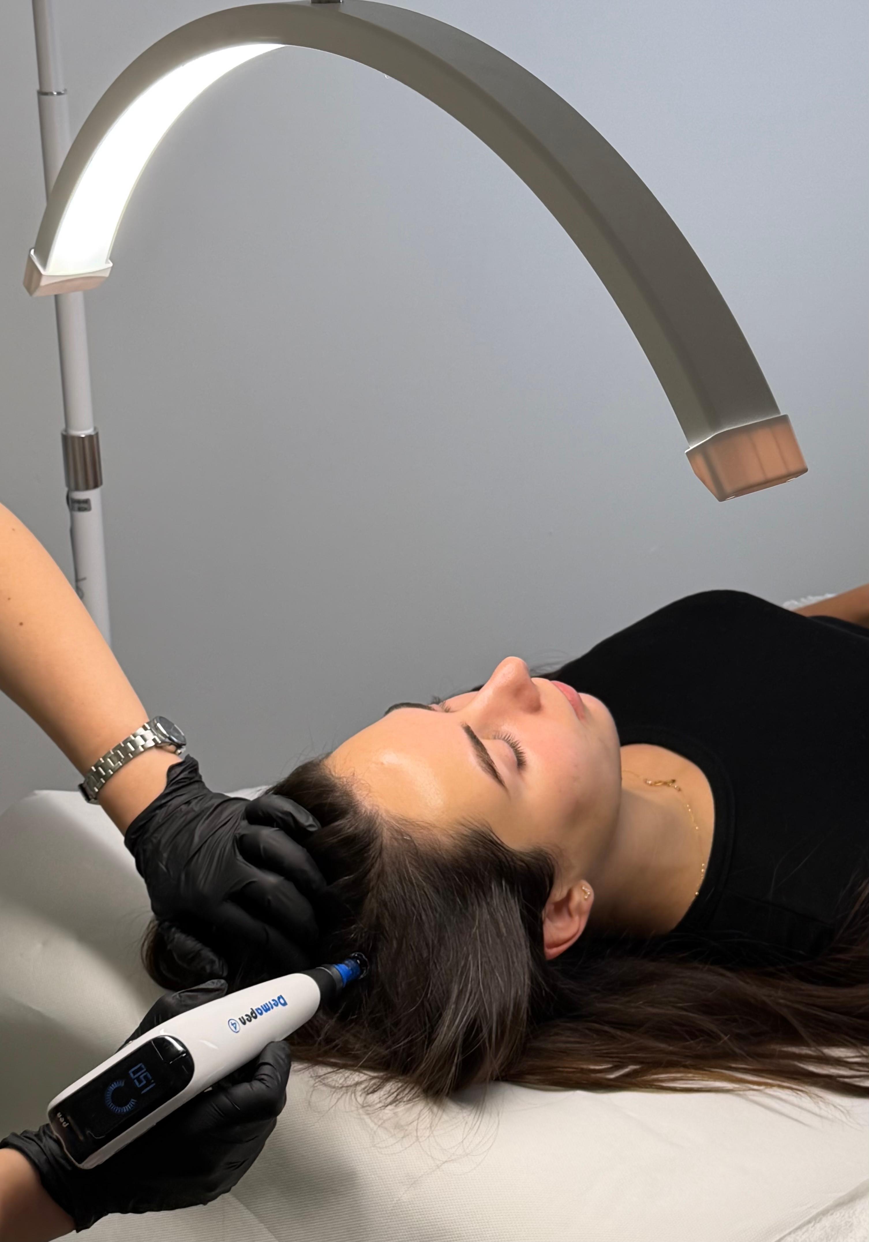 treatments.treatments.microNeedlingHair.title