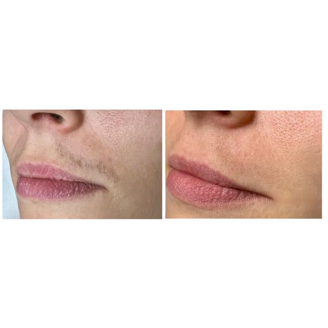 Benefit image