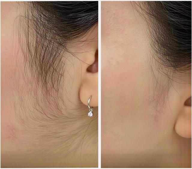 Benefit image