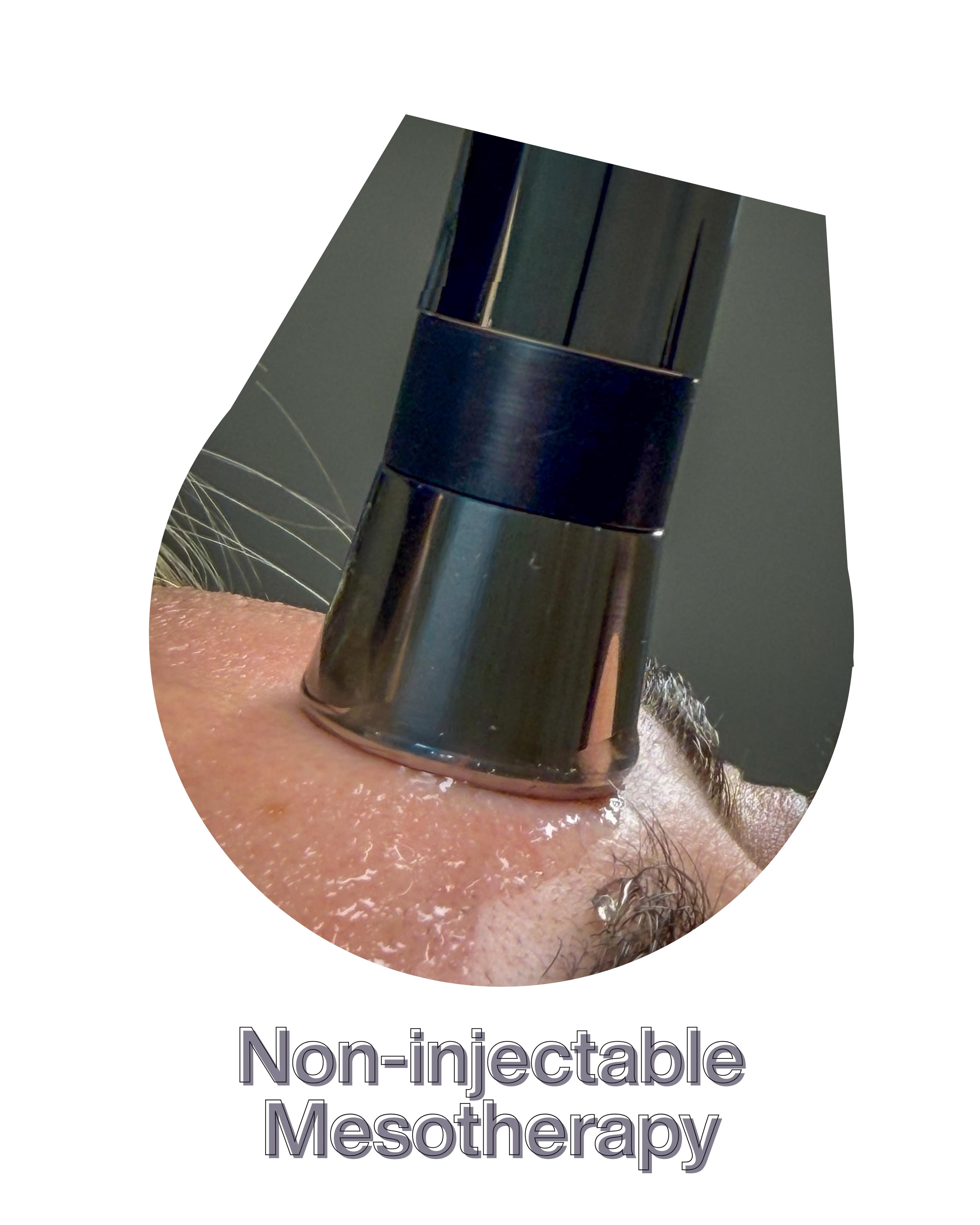 treatments.treatments.nonInjMesotherapy.title
