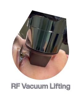 RF Vacuum eyes (Radiofrequency Vacuum)