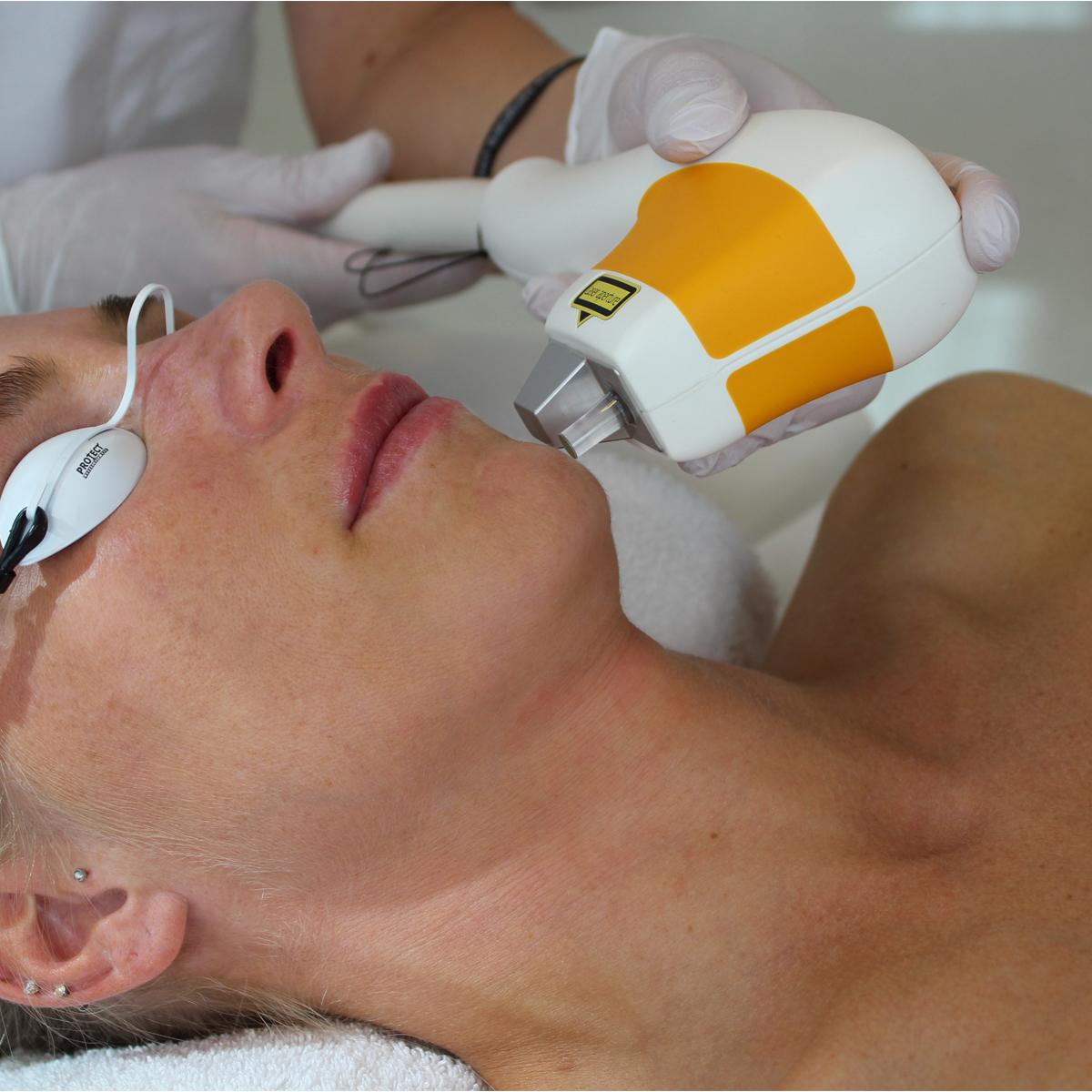 Asclepion MeDioStar Monolith laser at NeoXell Beauty Clinic